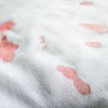 How To Remove Blood Stains From White Hotel Sheets